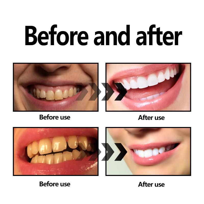 Teeth Whitening Powder Charcoa - Teeth Whitening Baking Soda recension och pris