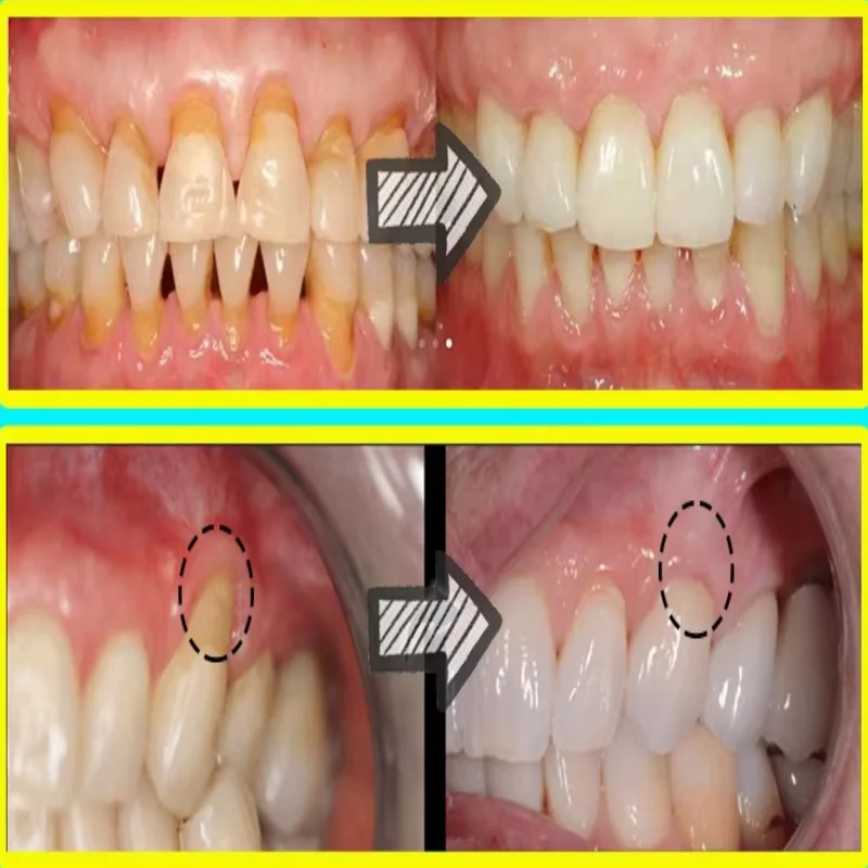 Quickly Repair Gum Serum Relie - Teeth Whitening Baking Soda recension och pris