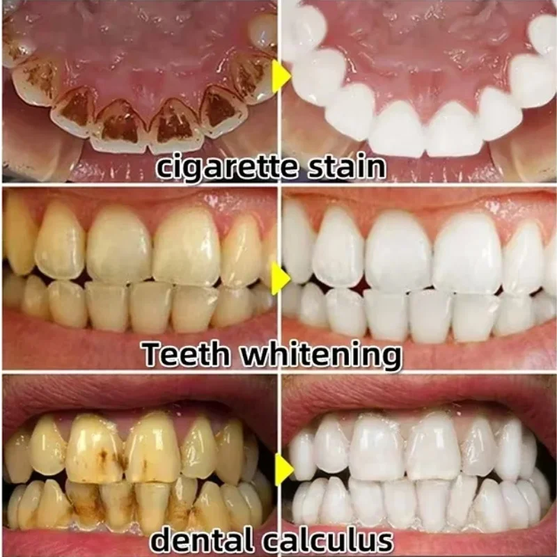 Quickly Repair Gum Serum Relie - Teeth Whitening Baking Soda recension och pris