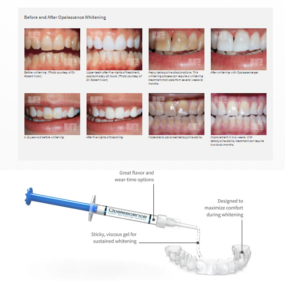 Opalescence Whitening 20% PF 2 - Teeth Whitening Gel recension och pris