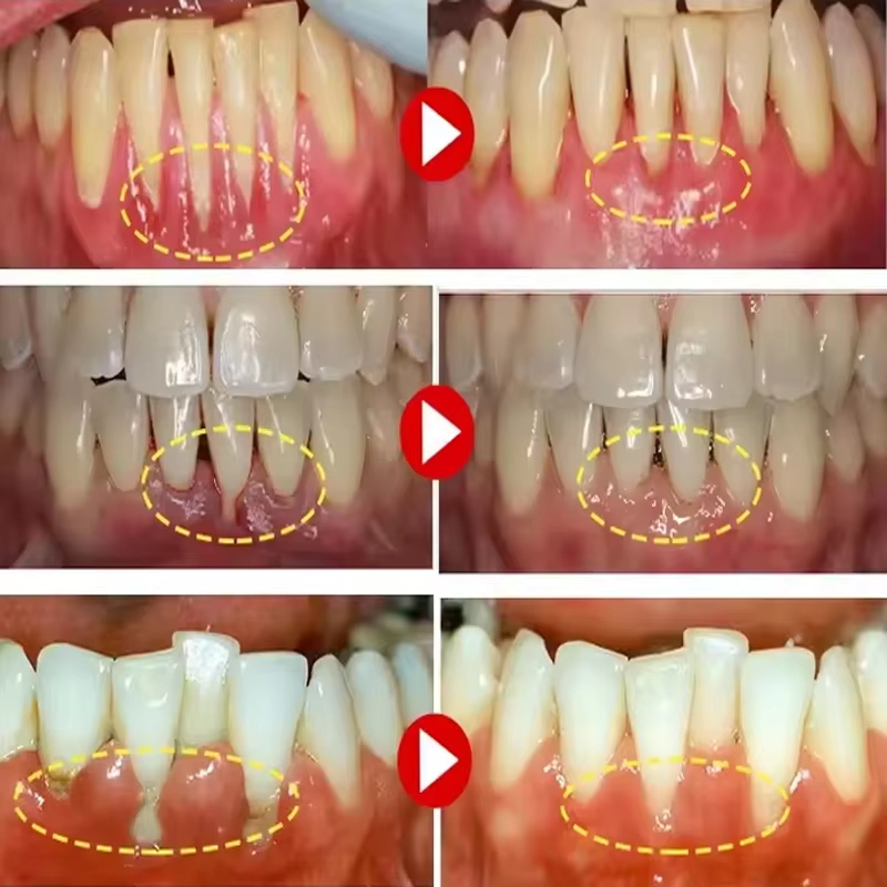Teeth Whitening Gel Gum Repair - Teeth Whitening Gel recension och pris