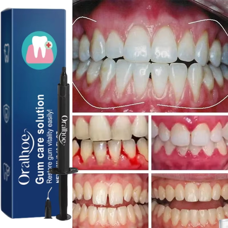 Teeth Whitening Gel Gum Repair - Teeth Whitening Gel recension och pris