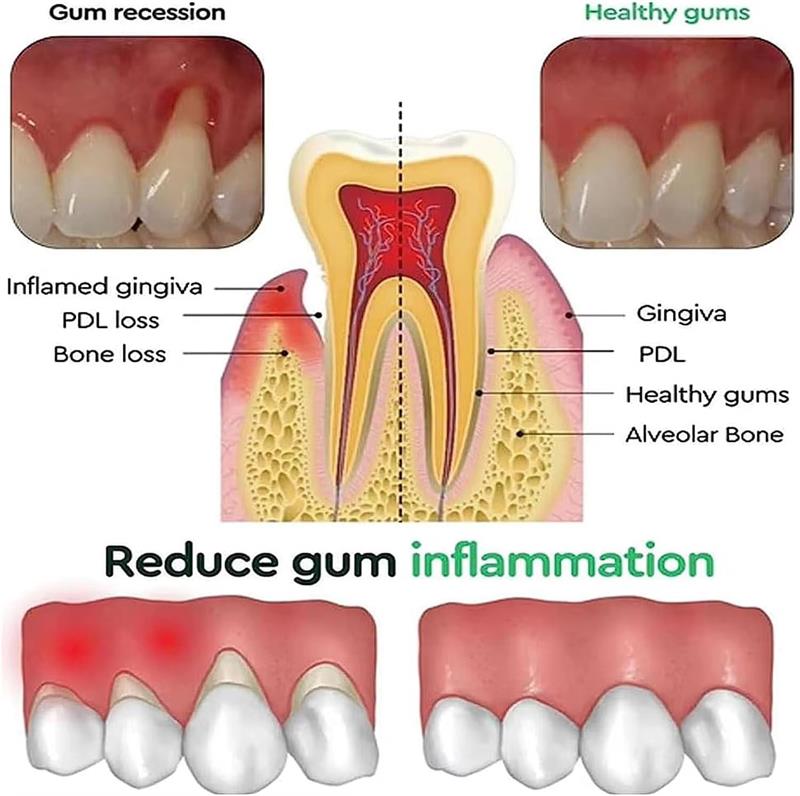 Teeth Whitening Gel Gum Repair - Teeth Whitening Gel recension och pris