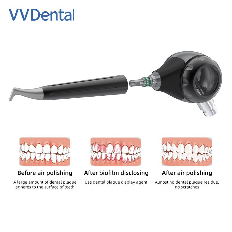 VVDental Air Polisher Jet Air  - Colgate Whitening Teeth recension och pris
