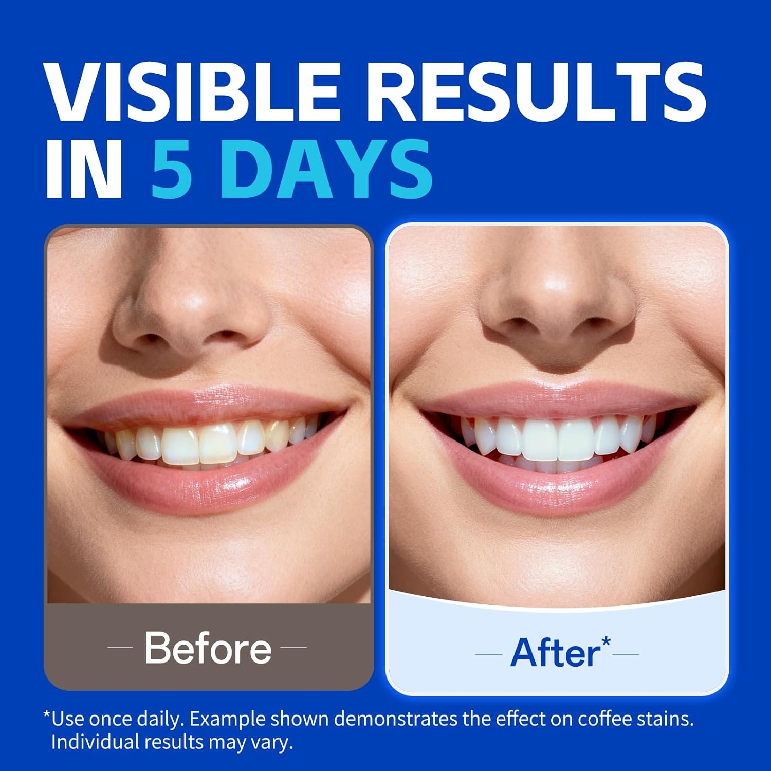 1/7 pairs Teeth Whitening Stri - Teeth Whitening Strips Crest recension och pris