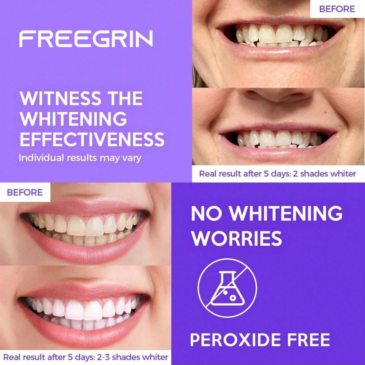 Deluxe Whitening Teeth Sticker - Teeth Whitening Strips Permanent recension och pris