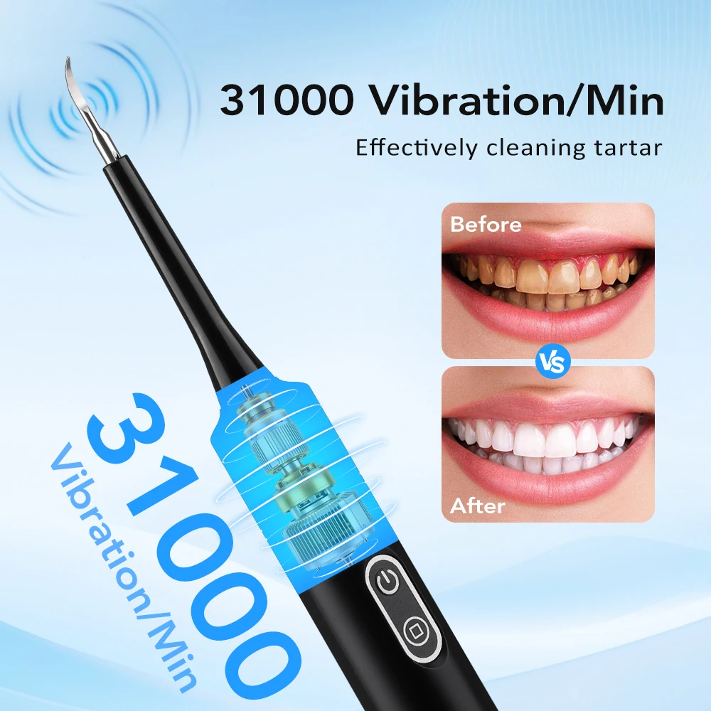 Electric Sonic Vibration Denta - Electric Toothbrush Sonic recension och pris